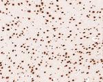 SAFB Antibody in Immunohistochemistry (Paraffin) (IHC (P))