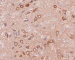 EMC4 Antibody in Immunohistochemistry (Paraffin) (IHC (P))