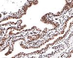 Nucleolin Antibody in Immunohistochemistry (Paraffin) (IHC (P))
