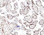 Nucleolin Antibody in Immunohistochemistry (Paraffin) (IHC (P))
