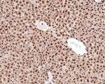 Nucleolin Antibody in Immunohistochemistry (Paraffin) (IHC (P))