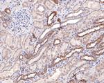 SLC25A12 Recombinant Rabbit Monoclonal Antibody (JE65-52)