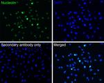 CRCP Recombinant Rabbit Monoclonal Antibody (JE65-42)