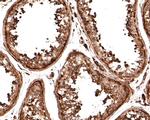 ATE1 Antibody in Immunohistochemistry (Paraffin) (IHC (P))