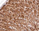 ATE1 Antibody in Immunohistochemistry (Paraffin) (IHC (P))