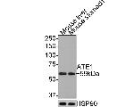 ATE1 Antibody in Western Blot (WB)