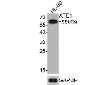 ATE1 Antibody in Western Blot (WB)