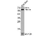 ATE1 Antibody in Western Blot (WB)