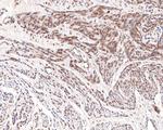 UFD1L Antibody in Immunohistochemistry (Paraffin) (IHC (P))