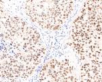 TRIM24 Recombinant Rabbit Monoclonal Antibody (JE64-31)
