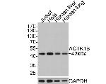 ACTR1B Antibody in Western Blot (WB)