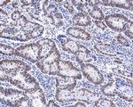 PPM1G Recombinant Rabbit Monoclonal Antibody (JE64-91)