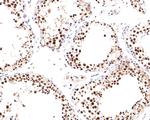 PPM1G Antibody in Immunohistochemistry (Paraffin) (IHC (P))