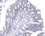 PPM1G Antibody in Immunohistochemistry (Paraffin) (IHC (P))