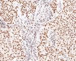 PNK Antibody in Immunohistochemistry (Paraffin) (IHC (P))