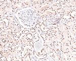 PNK Antibody in Immunohistochemistry (Paraffin) (IHC (P))