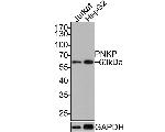 PNK Antibody in Western Blot (WB)