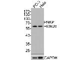 PNK Antibody in Western Blot (WB)