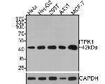 ITPK1 Antibody in Western Blot (WB)