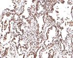 PER2 Antibody in Immunohistochemistry (Paraffin) (IHC (P))