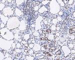 PIAS1 Antibody in Immunohistochemistry (Paraffin) (IHC (P))