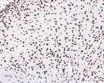 PIAS1 Antibody in Immunohistochemistry (Paraffin) (IHC (P))
