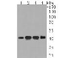 BCKDK Recombinant Rabbit Monoclonal Antibody (JE63-77)