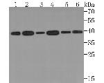 FDPS Recombinant Rabbit Monoclonal Antibody (JE63-33)