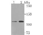 SPINK5 Recombinant Rabbit Monoclonal Antibody (JE63-90)