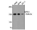 ZFYVE9 Antibody in Western Blot (WB)