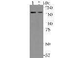ZFYVE9 Antibody in Western Blot (WB)