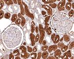 BIN1 Antibody in Immunohistochemistry (Paraffin) (IHC (P))