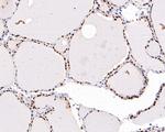PAX8 Antibody in Immunohistochemistry (Paraffin) (IHC (P))