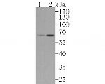 IKZF3 Recombinant Rabbit Monoclonal Antibody (JE62-81)