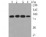 TRPV5 Recombinant Rabbit Monoclonal Antibody (JE62-37)