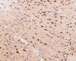 STX16 Antibody in Immunohistochemistry (Paraffin) (IHC (P))