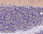 STX16 Antibody in Immunohistochemistry (Paraffin) (IHC (P))