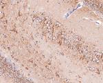 STX16 Antibody in Immunohistochemistry (Paraffin) (IHC (P))