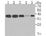 STX16 Antibody in Western Blot (WB)