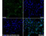 PKN2 Recombinant Rabbit Monoclonal Antibody (JE62-44)