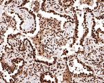TAF15 Antibody in Immunohistochemistry (Paraffin) (IHC (P))