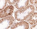 TAF15 Antibody in Immunohistochemistry (Paraffin) (IHC (P))