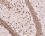 TAF15 Antibody in Immunohistochemistry (Paraffin) (IHC (P))