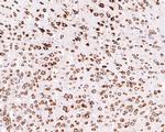 RPL26L1 Antibody in Immunohistochemistry (Paraffin) (IHC (P))
