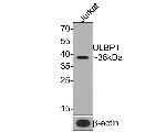 ULBP1 Recombinant Rabbit Monoclonal Antibody (JE65-75)