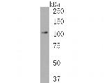 RIG-I Recombinant Rabbit Monoclonal Antibody (JE60-05)