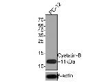 Cystatin B Antibody in Western Blot (WB)