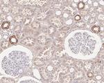 HMGCS2 Recombinant Rabbit Monoclonal Antibody (JE54-76)
