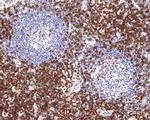 CD3 Antibody in Immunohistochemistry (Paraffin) (IHC (P))