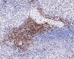 CD3 Antibody in Immunohistochemistry (Paraffin) (IHC (P))